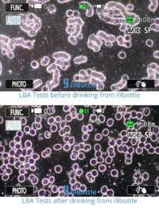 Bouteille I9 vitalisante, la structure du sang après utilisation